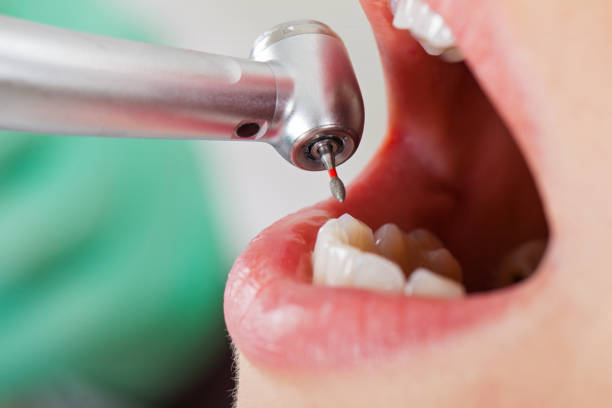 Best Walk-In Emergency Dental Services in Centerville, TN